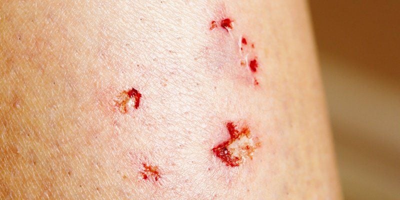 Ý nghĩa tâm linh của giấc mơ thấy máu